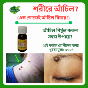 আঁচিল সাফা (ক্রীম) ছোট ফাইল রোগীদের জন্য