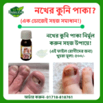 নেইল কিউর (নখের কুনি পাকা)